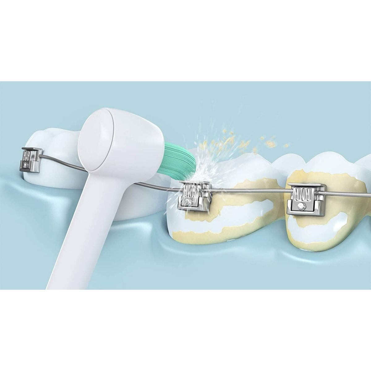 Irygator bezprzewodowy EW1513 czyszczenie aparatu ortodontycznego