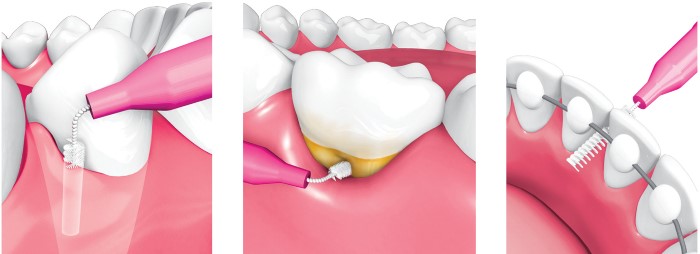 jak używać szczoteczek międzyzębowych Piksters
