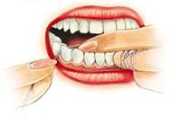prawidłowe nitkowanie zębów