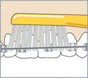Efektywne czyszczenie przy aparatach ortodontycznych