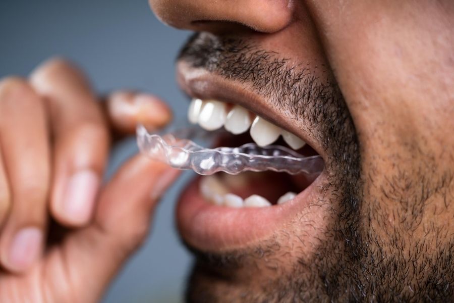speak artery unit Szyna relaksacyjna. Koniec z problemem zgrzytania zębami? - Blog Shop Dent